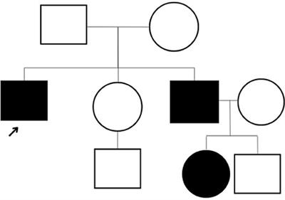 Autosomal dominant GDAP1 mutation with severe phenotype and respiratory involvement: A case report